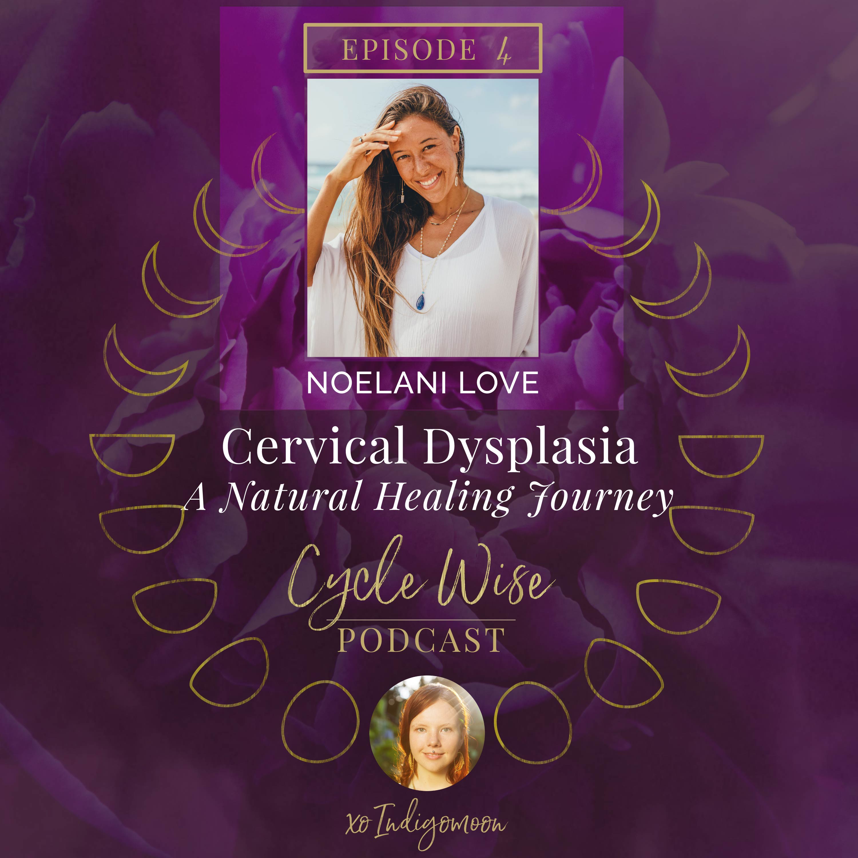 Cervical Dysplasia – A Natural Healing Journey with Noelani Love